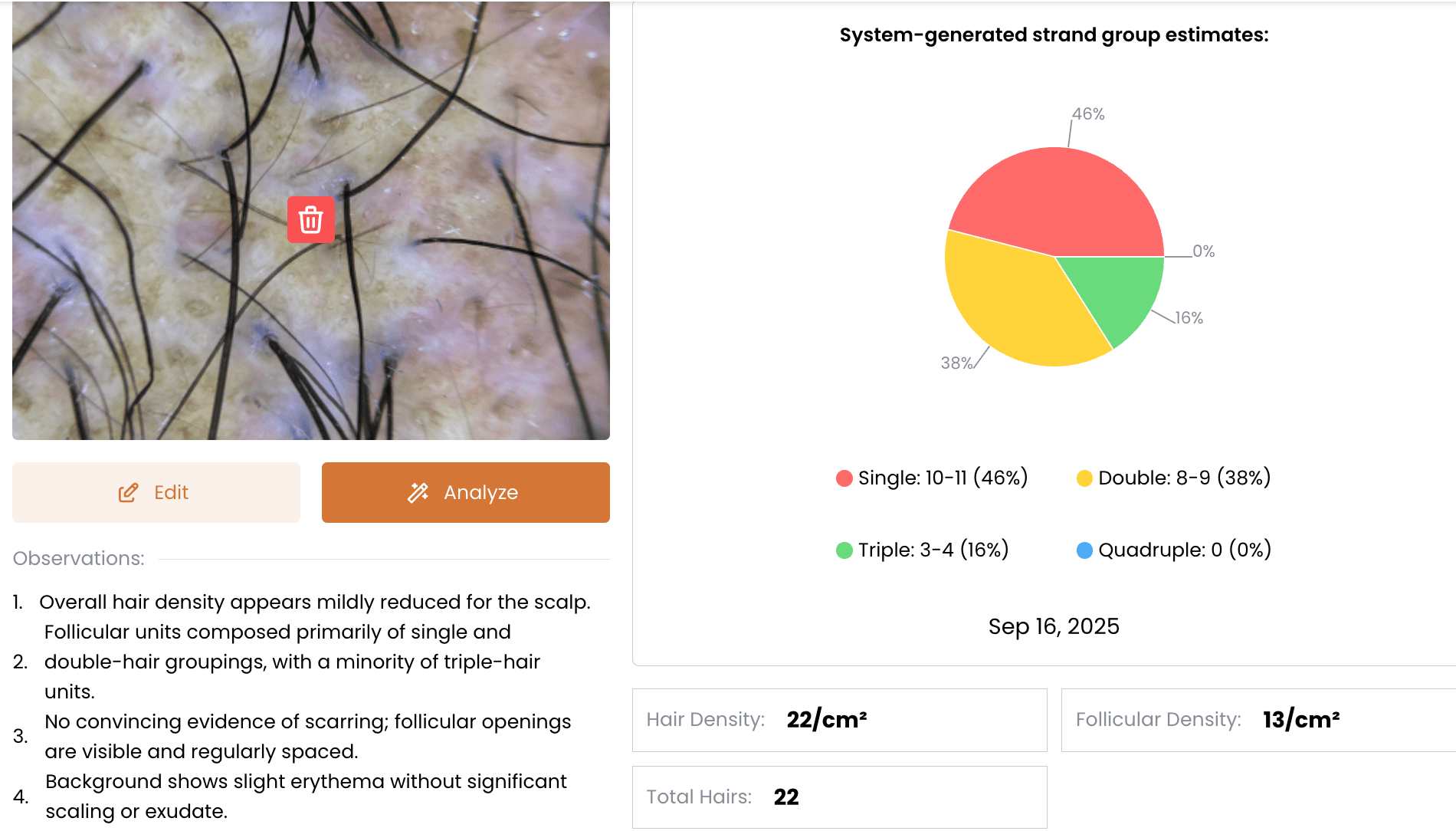 AI Summary Preview AI Summary Preview